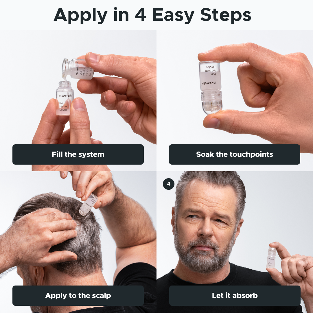 Microfollic™ Hair Infusion System